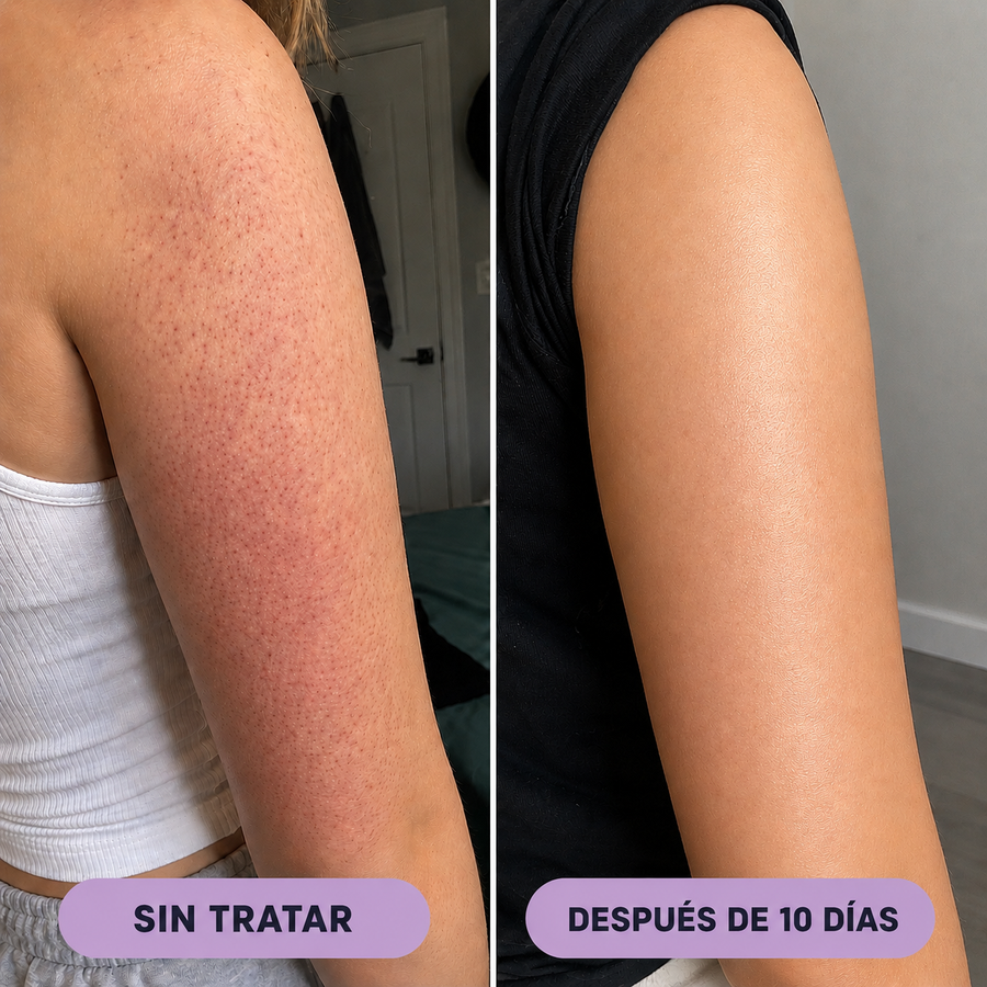 El fondo empieza a aclarar