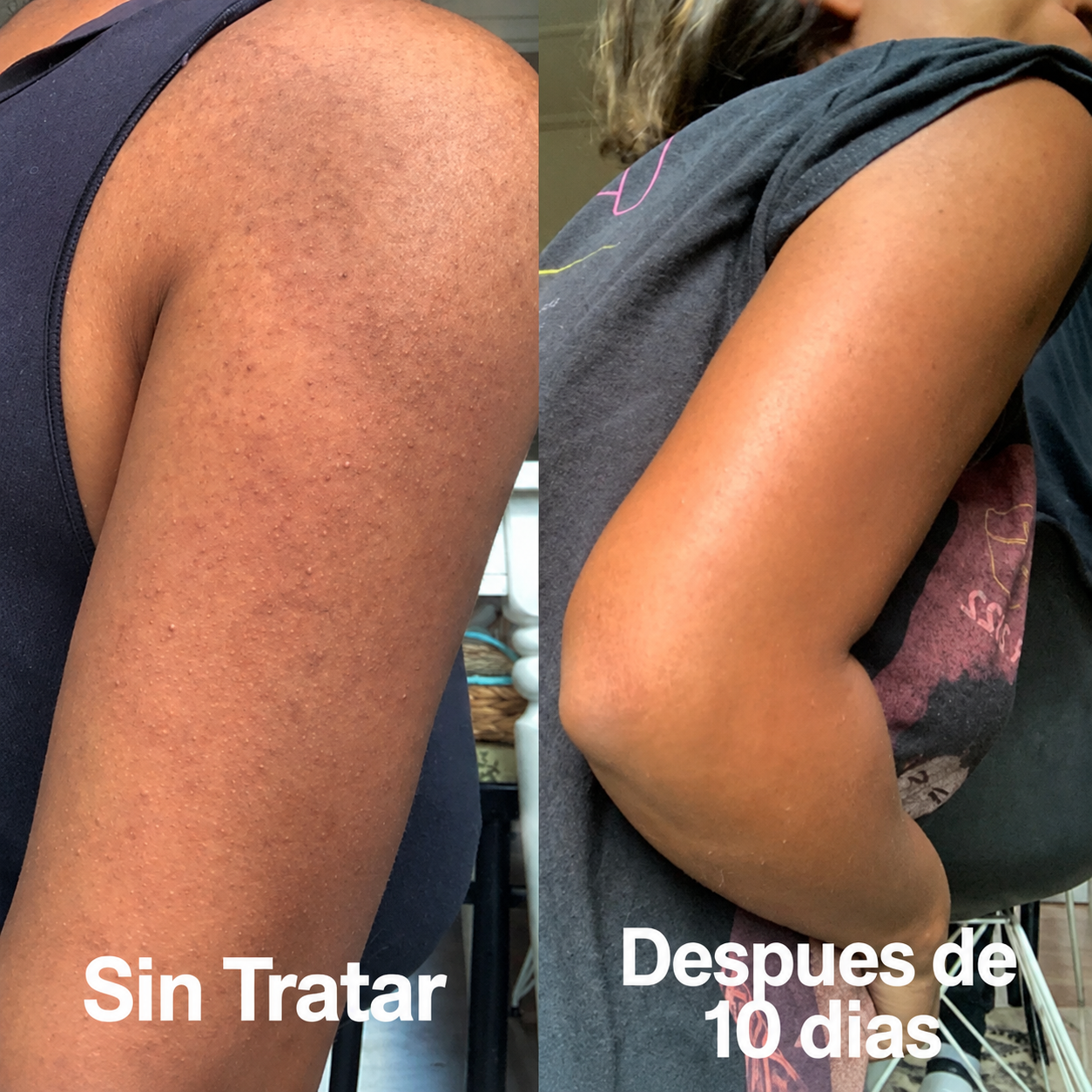 Antes y despues a los 10 dias de uso
