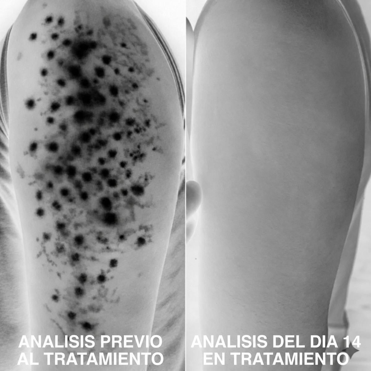 Analisis de textura de la piel del brazo