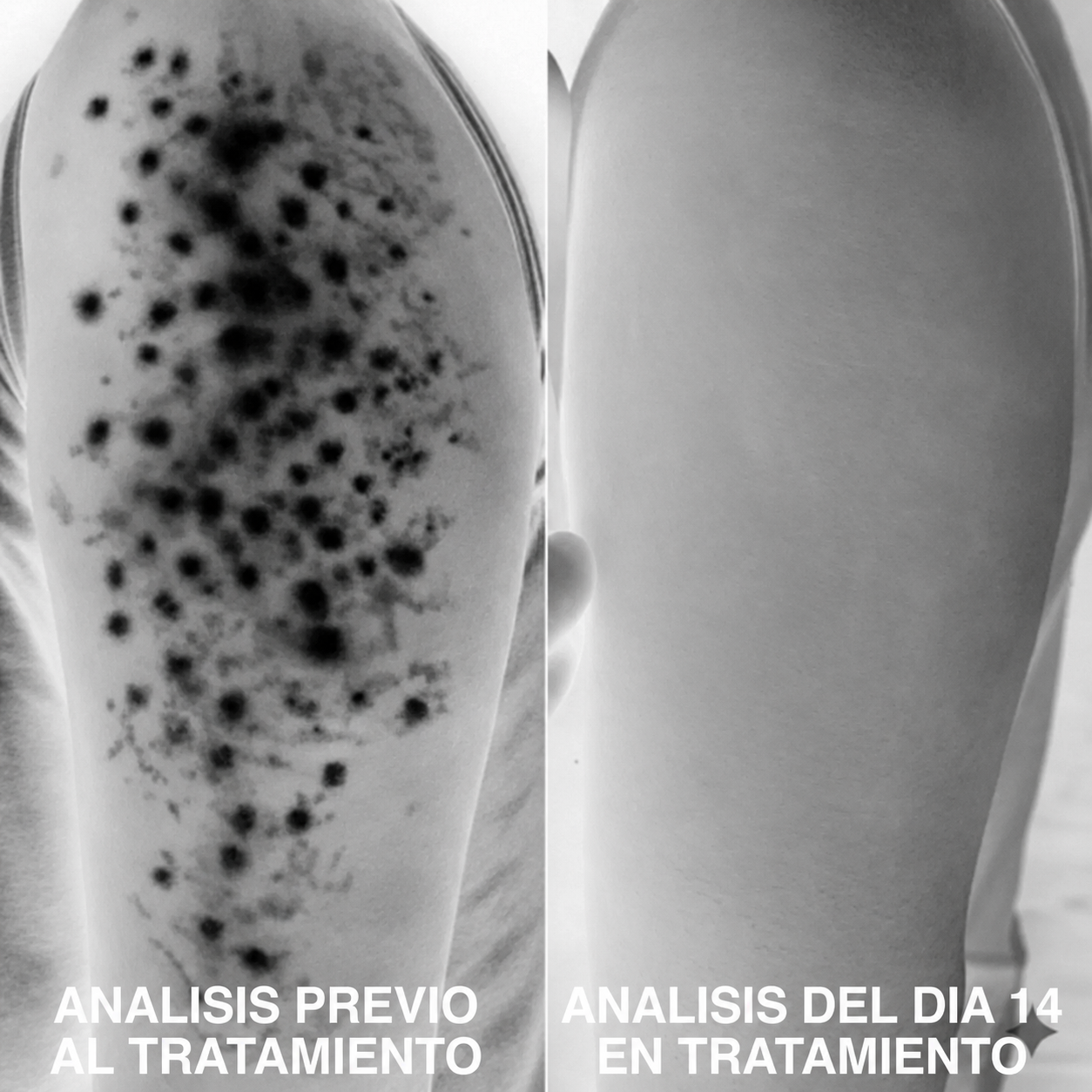 Analisis de textura de la piel del brazo