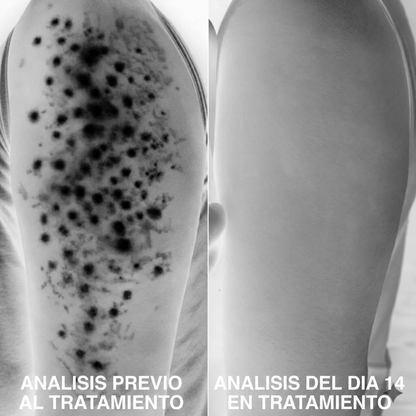 Analisis de textura de la piel del brazo