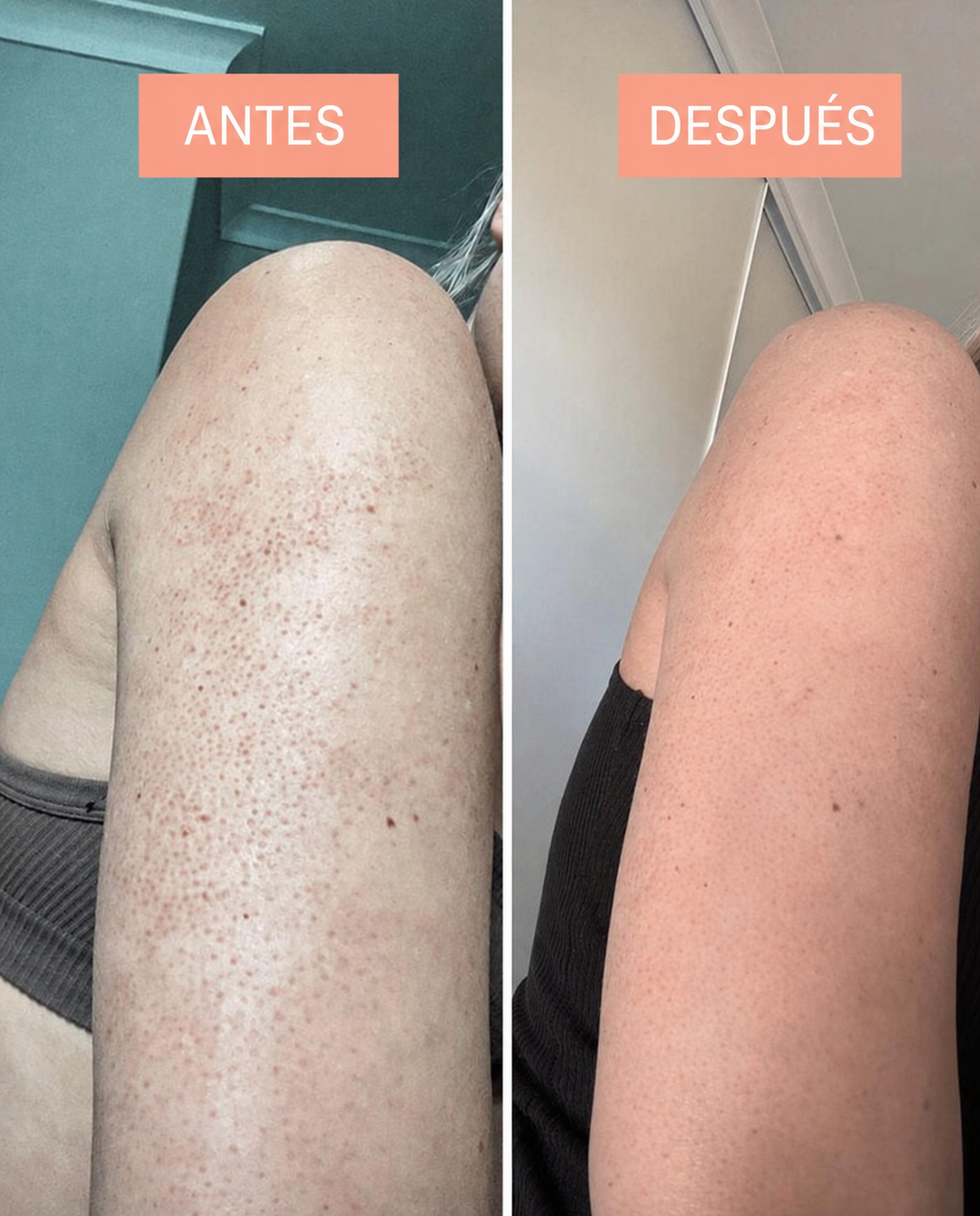 Antes y despues brazos